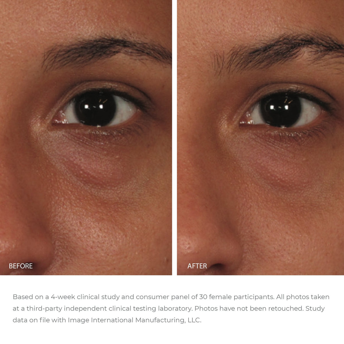 IMAGE ORMEDIC Balancing Eye Lift Gel