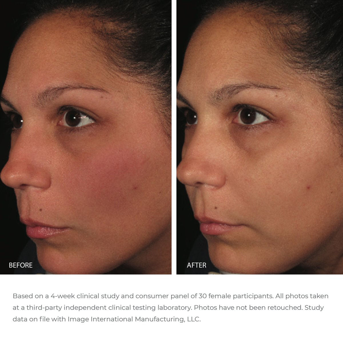 IMAGE ORMEDIC Balancing Antioxidant Serum